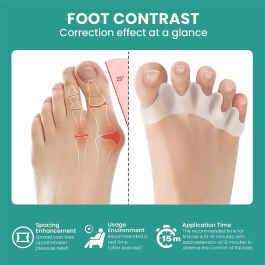 TrueStride™ Toe Alignment System